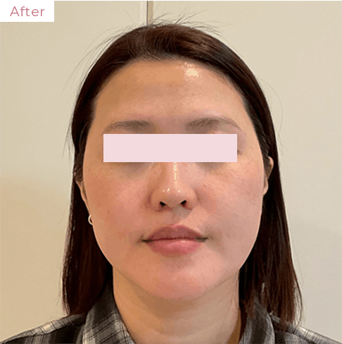 代々木上原の美容皮膚科｜シミ・シワ・毛穴・そばかす・くすみならピコレーザー導入のAK dental care