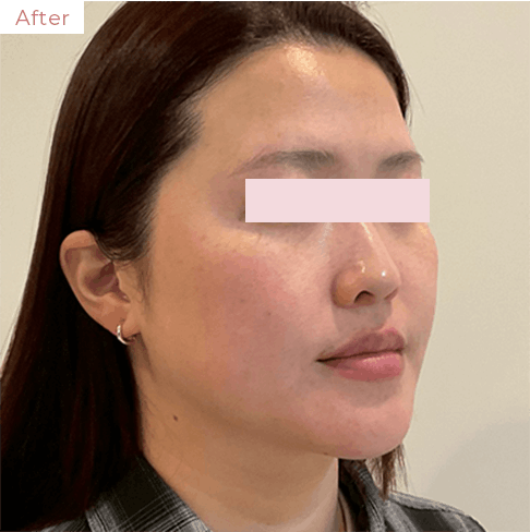 代々木上原の美容皮膚科｜シミ・シワ・毛穴・そばかす・くすみならピコレーザー導入のAK dental care