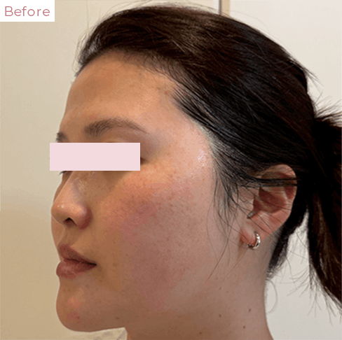 代々木上原の美容皮膚科｜シミ・シワ・毛穴・そばかす・くすみならピコレーザー導入のAK dental care