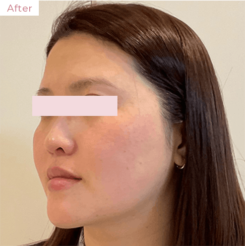 代々木上原の美容皮膚科｜シミ・シワ・毛穴・そばかす・くすみならピコレーザー導入のAK dental care