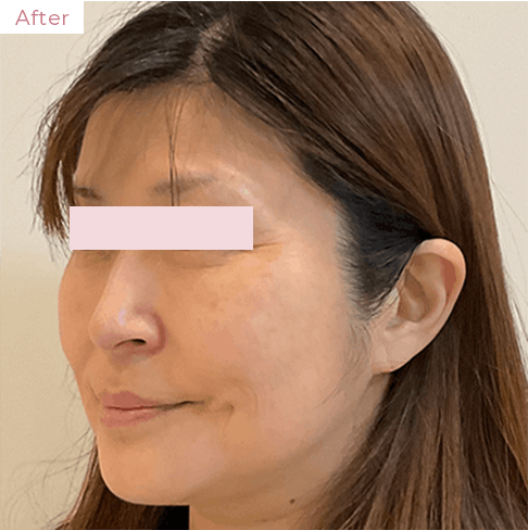 代々木上原の美容皮膚科｜シミ・シワ・毛穴・そばかす・くすみならピコレーザー導入のAK dental care