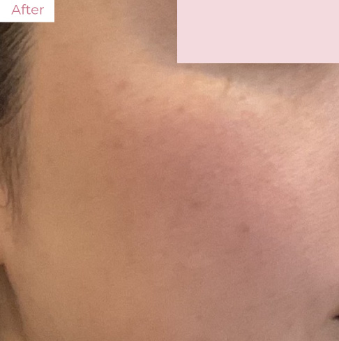 AT_20260323_02 - 代々木上原の美容皮膚科AK dental care 代々木上原の美容皮膚科|シミ・シワ・毛穴・そばかす・くすみならピコレーザー導入のAK dental care