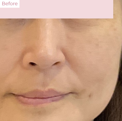 代々木上原の美容皮膚科｜シミ・シワ・毛穴・そばかす・くすみならピコレーザー導入のAK dental care