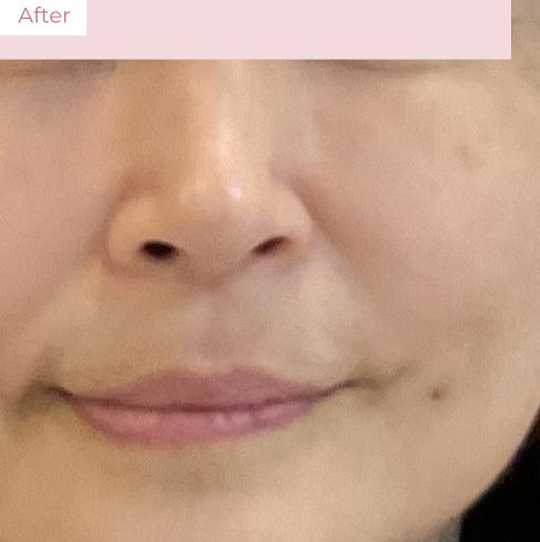 代々木上原の美容皮膚科｜シミ・シワ・毛穴・そばかす・くすみならピコレーザー導入のAK dental care